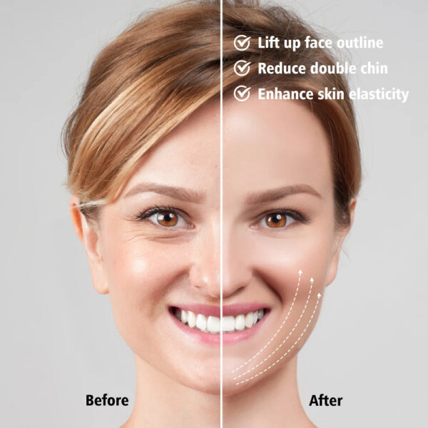 Facial V Lifting Vibration Massager LED Photon Therapy Facial Lifting Device Double Chin V Face Shaped Cheek Lift Belt Machine - Image 3